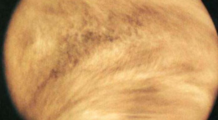Gas spotted in Venus’s clouds could be a sign of alien life
