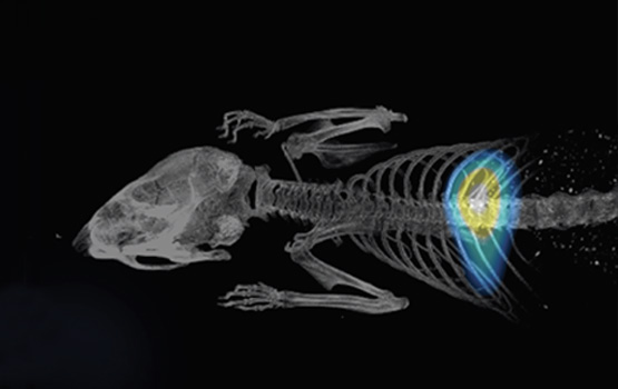 A world first in imaging technology – Medicine, Nursing and Health Sciences – Monash University