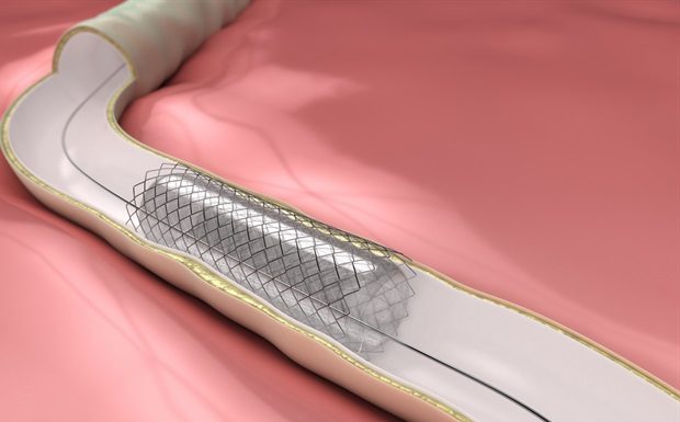 New technology can help improve various materials implanted into the human body – News-Medical.Net