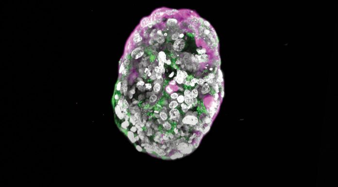 The Download: embryo ethics, and reducing chatbot risks