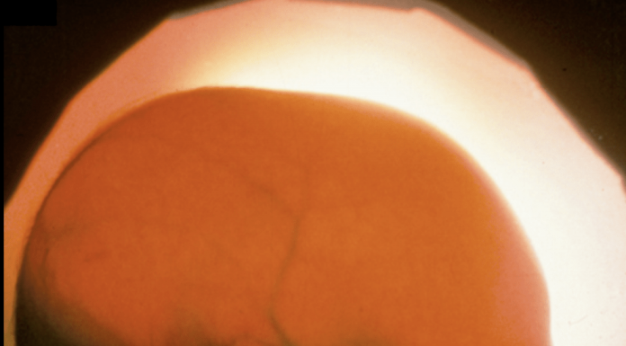 Inside the stealthy startup that pitched brainless human clones