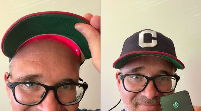 GroWell Cap Review: I Have Hair for the First Time in 15 Years
