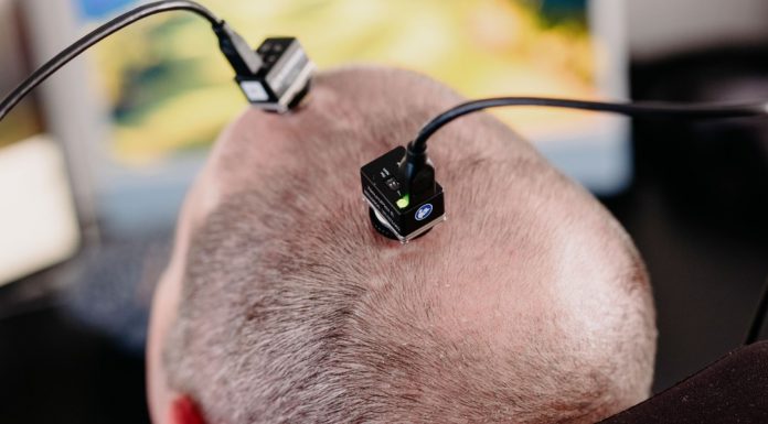 This man with ALS is “the first power user” of a brain implant that lets him speak